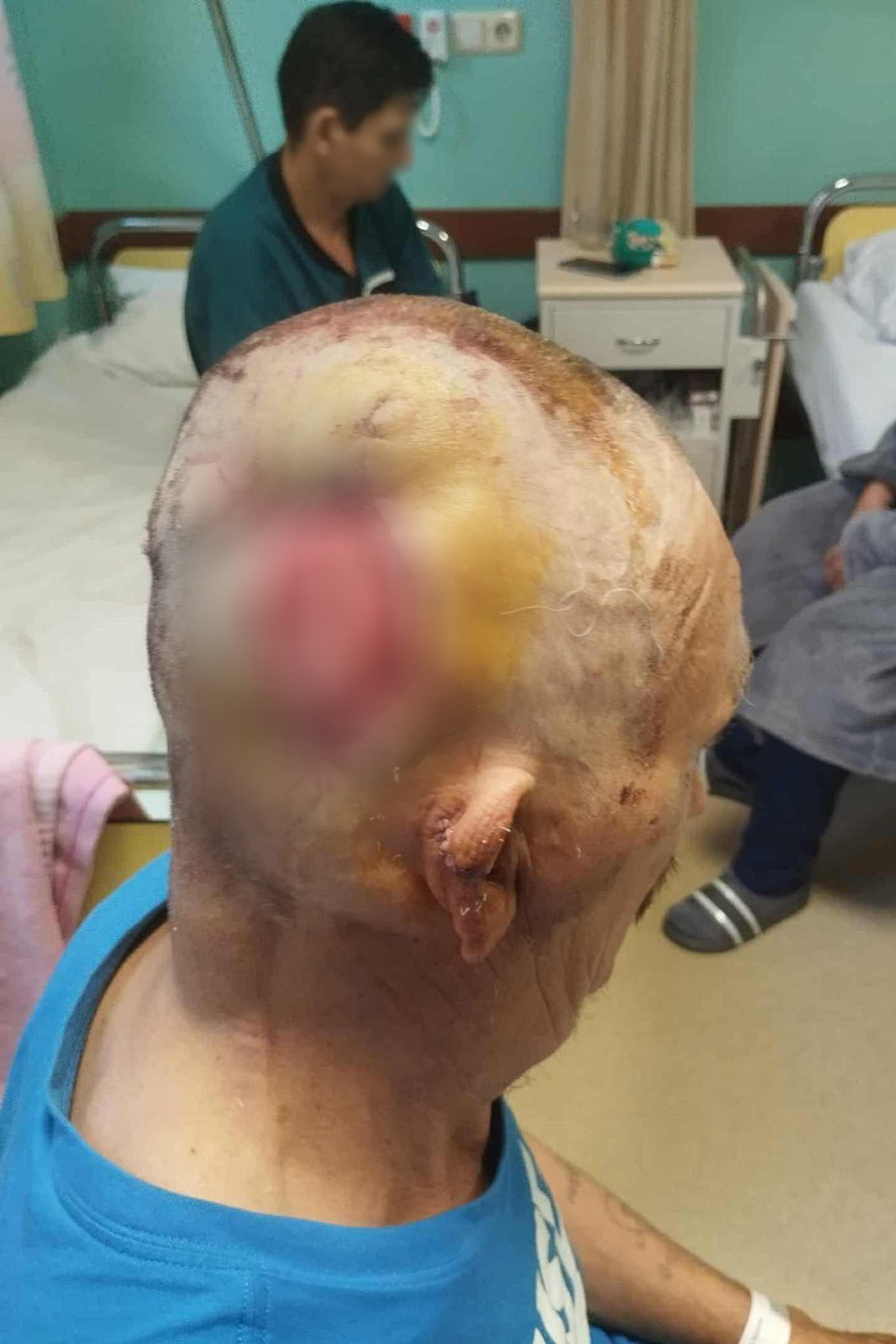 A fején sérült meg súlyosabban a pásztor