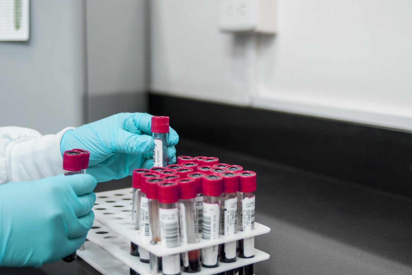 Akár heteket is várni kell a vérvételre egyes Hargita megyei laboratóriumokban azoknak, akik küldőpapírral, ingyenesen vennék igénybe a szolgáltatást •  Fotó: Pixabay