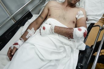 Nem mindenkinek jár megfelelő kártérítés a medvetámadás után