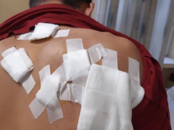 Fiatal fiút marcangolt össze egy medve – az áldozat nyilatkozott lapunknak