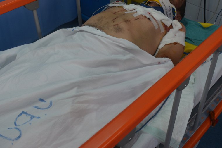 Súlyosan megsebesített egy férfit a medve Csíkszentkirályon