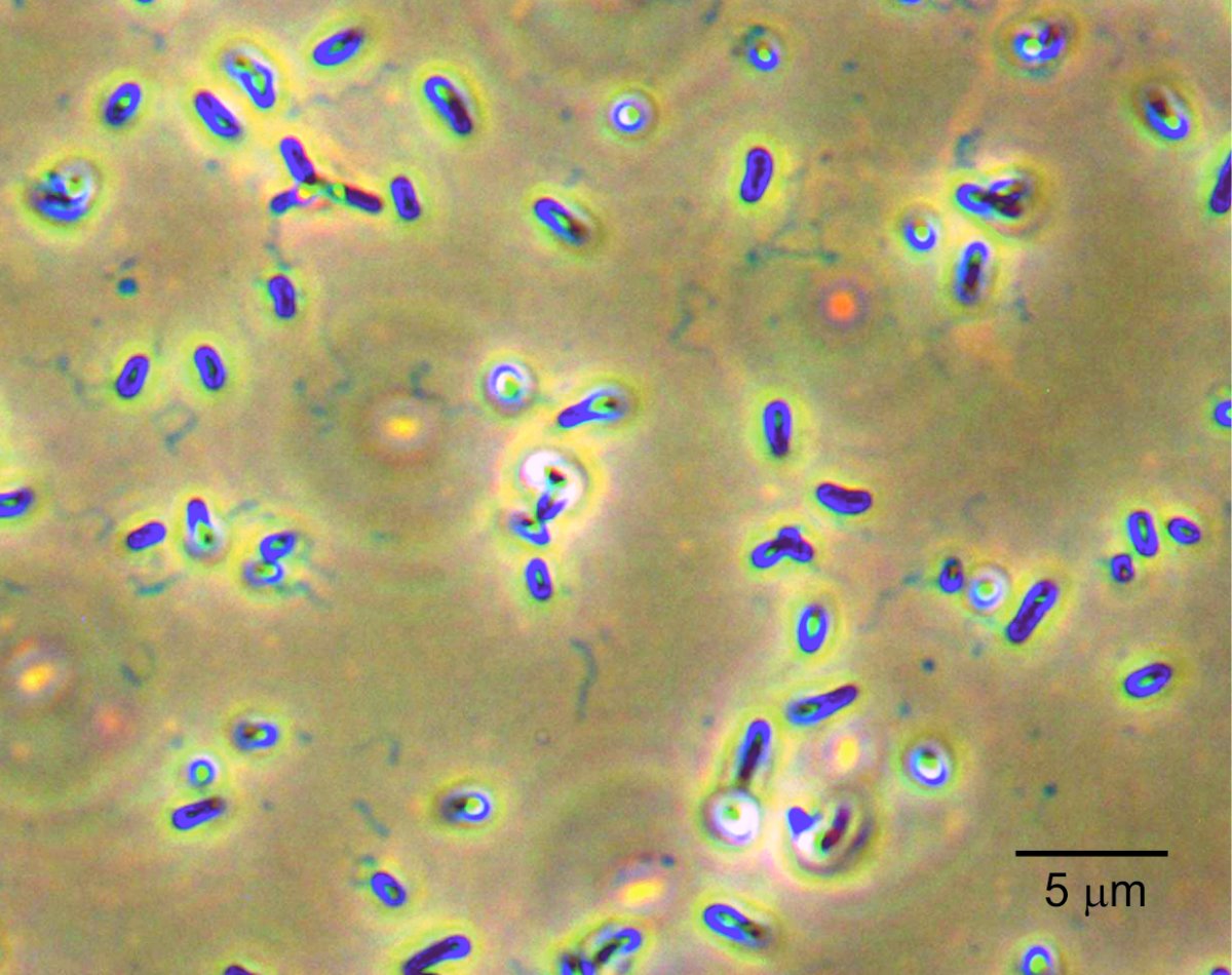 A Rhizobium aquaticum baktérium fénymikroszkópos képe kristályibolyát tartalmazó csillófestékkel történő festés után •  Fotó: Sapientia EMTE