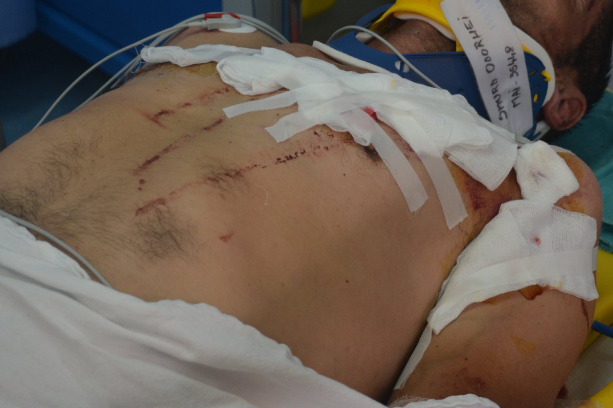 A medve súlyosan megsebesítette a csíkszentkirályi férfit. Puskavégre kerülhet • Fotó: Sajtószolgálat/HMT