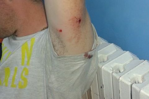 Az áldozat sebei •  Fotó: Sajtószolgálat/Hargita Megye Tanácsa