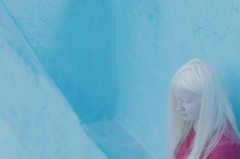 A különc, akinek mágikus erőt tulajdonítanak.  Az albínó szereplő filmben és élőben
