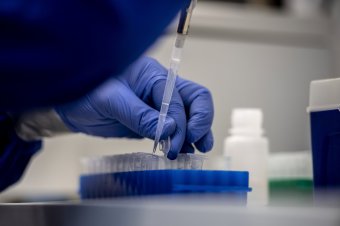 Lényegesen több koronavírus-fertőzöttet azonosítottak, mint influenzásat