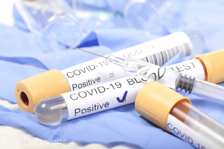 Koronavírus: már több mint félezerre rúg a diagnosztizált fertőzöttek száma Romániában