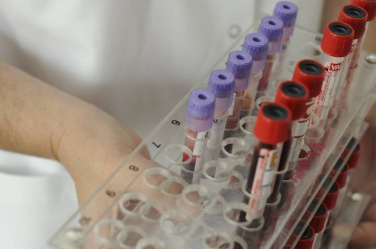 Megelőző intézkedésként előjegyzés