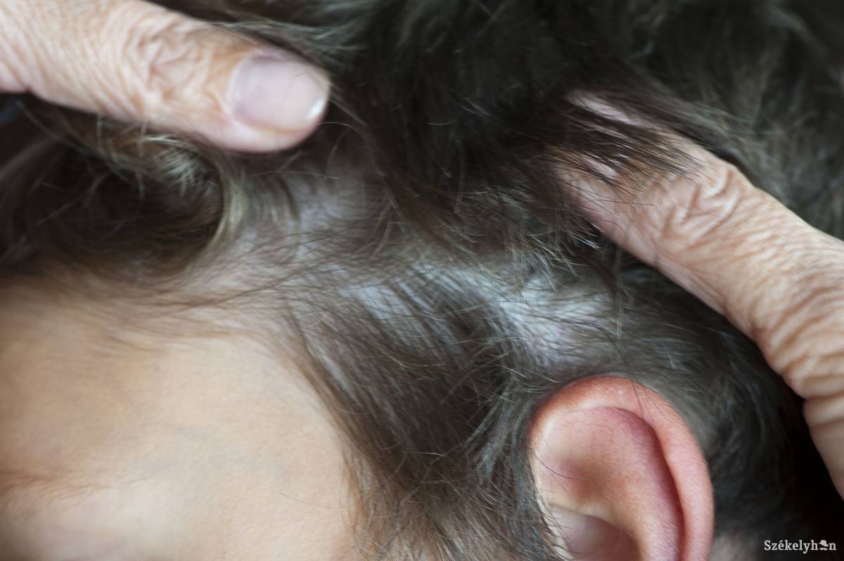 &bullet;  Fotó: Kristó Róbert