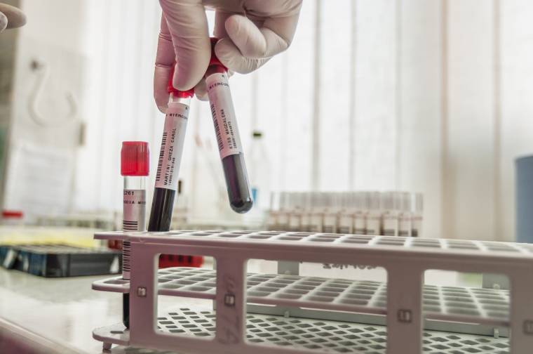 Tanévkezdés: nem kötelező a laborvizsgálat