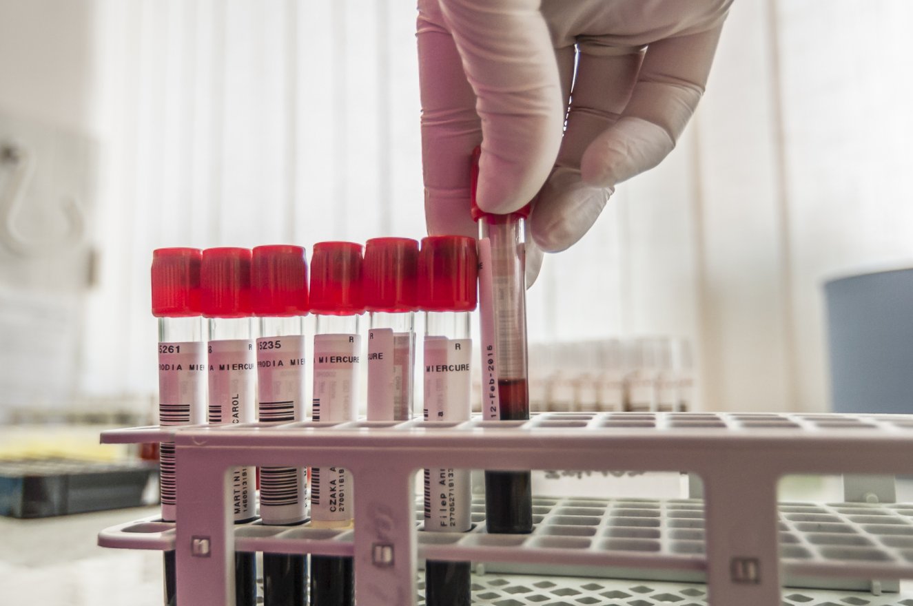 Ha vért adnak, genetikai elemzést kaphatnak a ritka és autoimmun betegségekben szenvedők