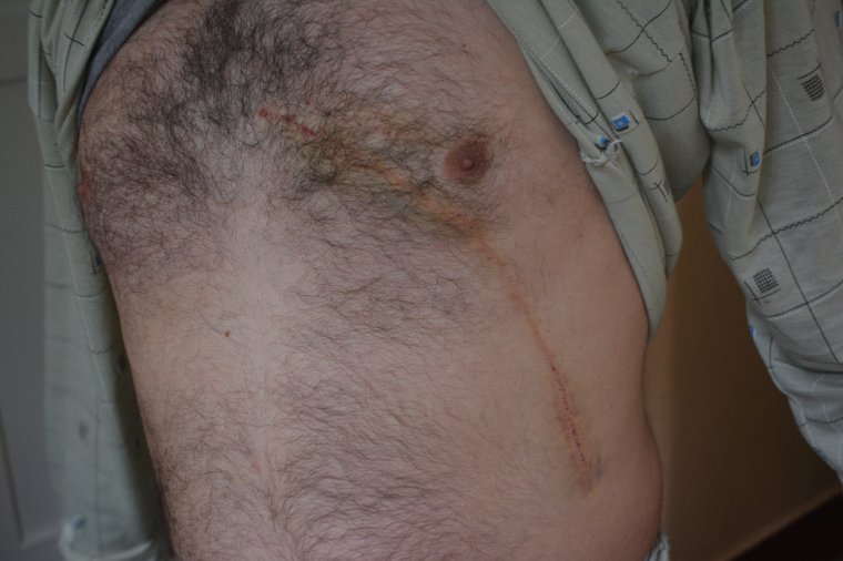 Kutyasétáltató helyire támadt a medve Tusnádfürdőn