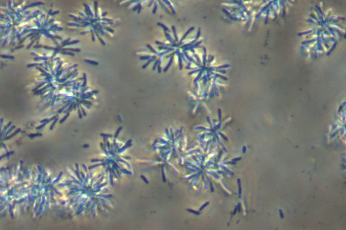 A Siculibacillus lacustris SA-279 kódjelű típustörzsének rozettákat formáló sejtjei fénymikroszkópos fáziskontraszt felvételen százszoros nagyításon. A sejtek hossza 1,3-2,5 µm •  Fotó: dr. Felföldi Tamás