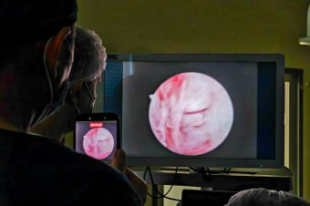 Műtétpremier a csíkszeredai kórházban