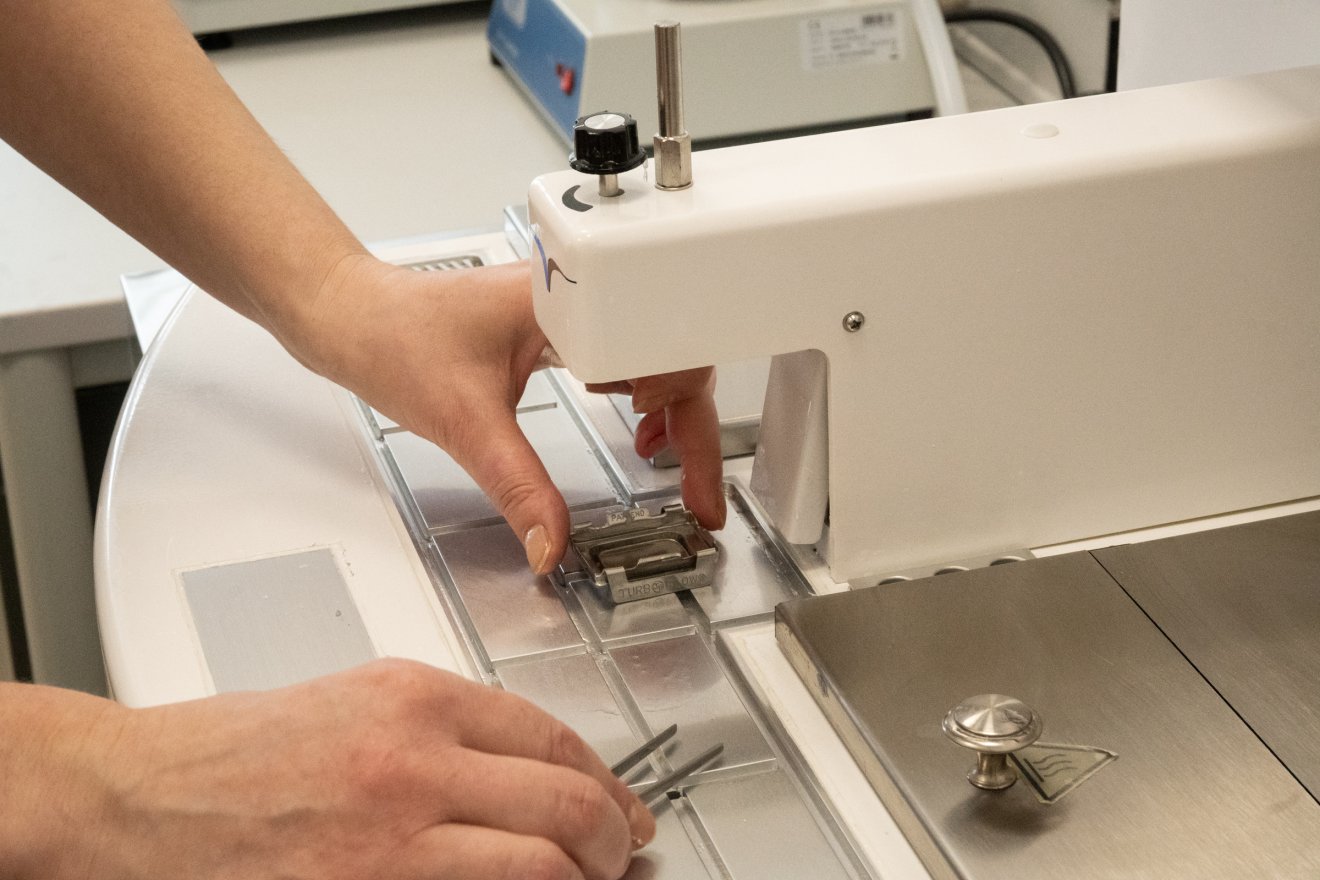 Kilencmillió lejes uniós beruházás: szintet lépő patológiai labor Csíkszeredában