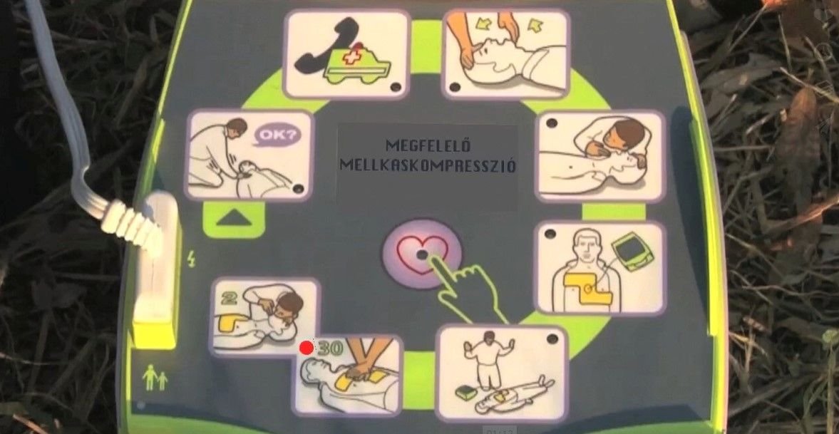 Az újraélesztés lépései egy oktatógrafikán •  Fotó: Defibrillátor Plusz Kft.