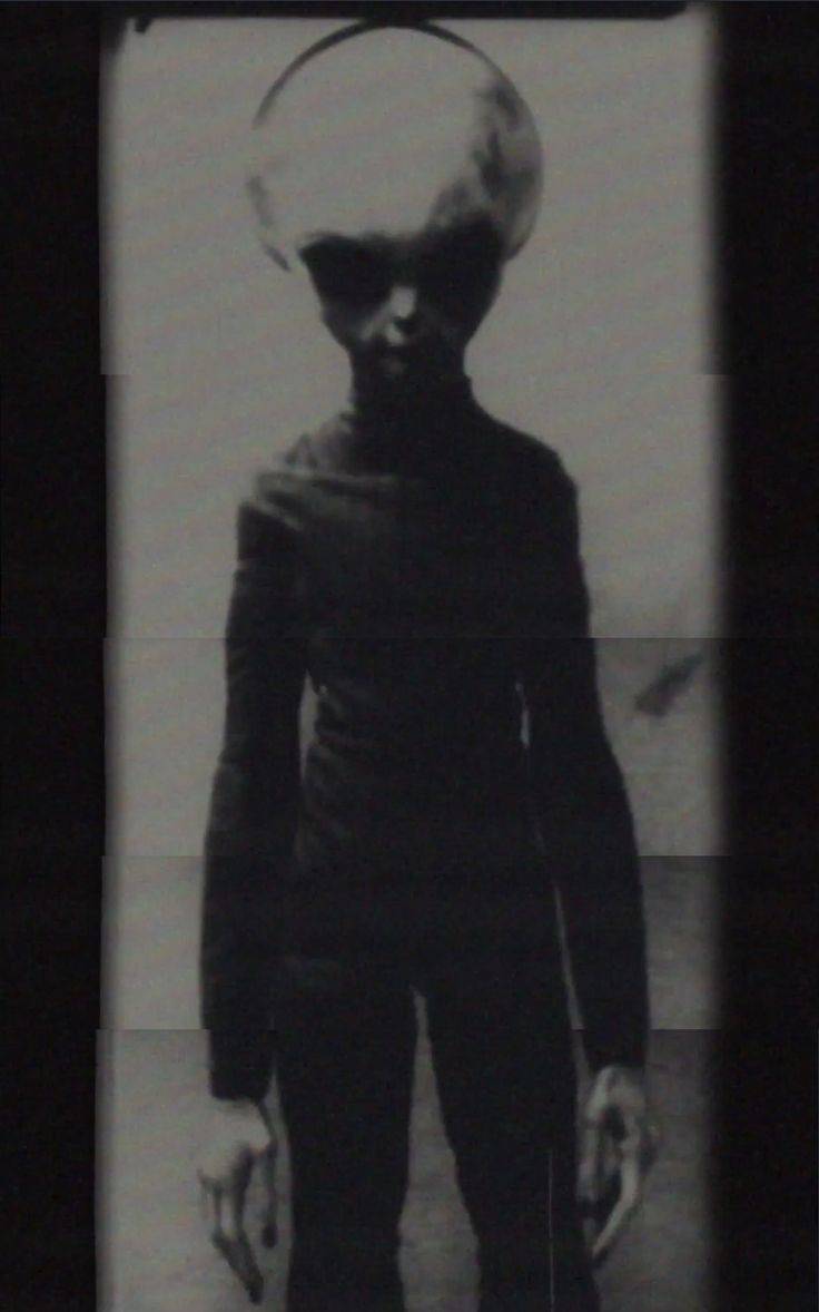 A roswelli eset „túlélőjéről” készült felvétel hitelessége kérdéses &bullet;  Fotó: PINTEREST