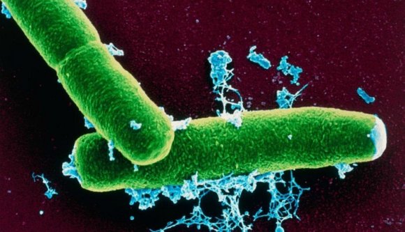 Antrax-gyanús esetek Botoşani megyében