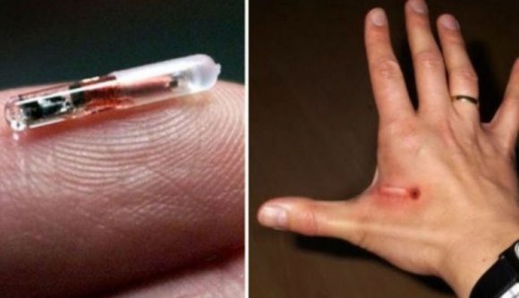 Szép új világ: bemikrochipezi dolgozóit egy amerikai cég