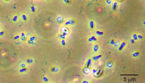 Különleges baktériumfajt fedeztek fel a Szent Anna-tóban