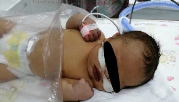 Kínos: helyi szakemberek hiányában brit orvosok menthetik meg a szívműtétre váró csecsemőt