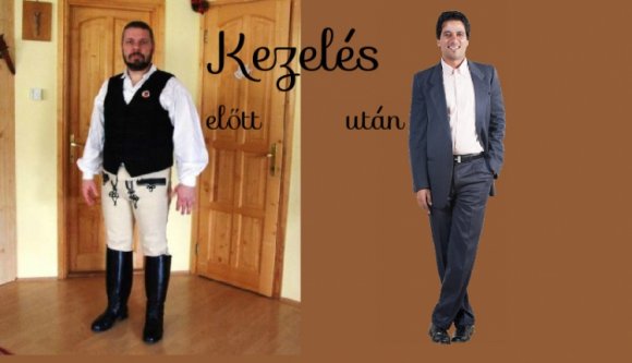 Mi a székely? Egy bőrbetegség!