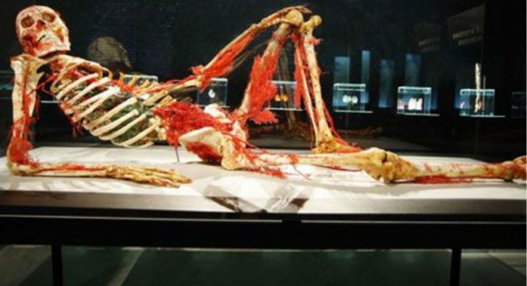 Temesvár: kiverte a biztosítékot a „hullakiállítás”