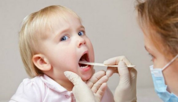 Még mindig dúl a kanyarójárvány