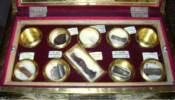 Sétált az utcán, több mint 30 emberi csonttal a zsákjában