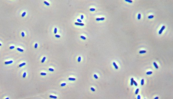 Eddig ismeretlen baci öregbíti a csíki Sapientia hírnevét