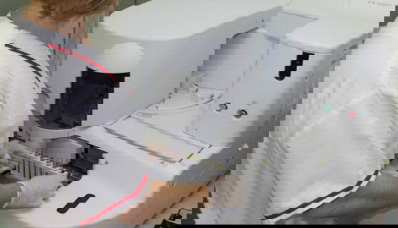 Szélesítik a koronavírus-tesztelést, már amennyire a körülmények engedik