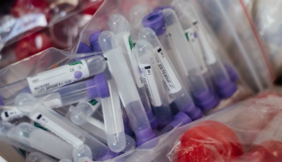 Mennyire reális a koronavírus-járvány áldozatainak száma Romániában?