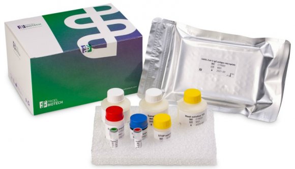 Egy eredmény, amire büszkék lehetünk: erdélyi magyar kutatók fejlesztették ki az első hazai antitest tesztet