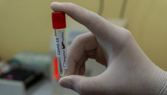 A kettészakadt Románia: néhány megyében a 2000-et közelíti a napi tesztek száma, máshol a 30-at sem éri el