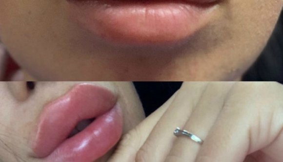 Kis hazánk, az álorvos-paradicsom: most épp egy újabb „plasztikai sebész” bukott le