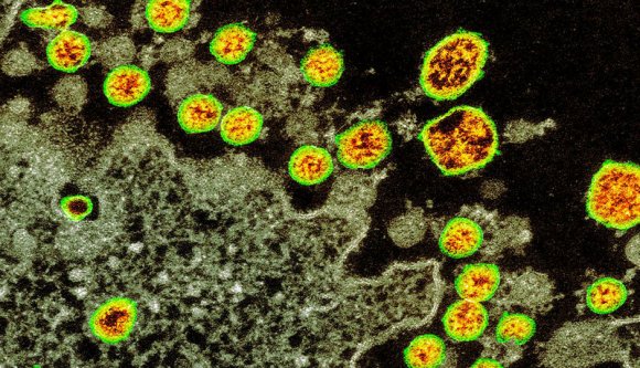 Járványhelyzet: folytatódik a csökkenő trend, de egyre több a súlyos beteg