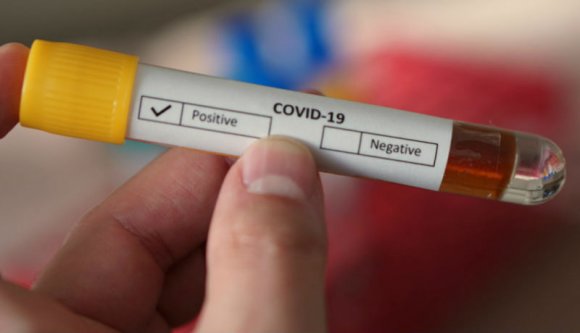 Kedvezőbb adatok: 2000 alatt az új fertőzöttek, 1000 alatt az intenzív osztályon ápoltak száma