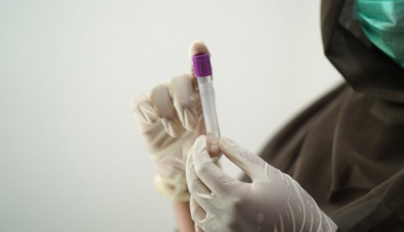 Remek, már csak a brazil vírusmutáns hiányzott a romániai járványmátrixból