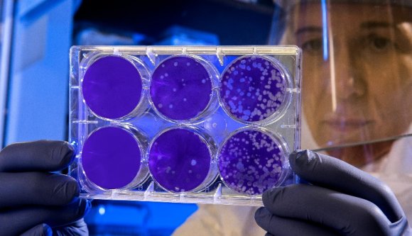 Egyre nyilvánvalóbb, hogy a brit vírustörzs okozza a mostani magas esetszámokat