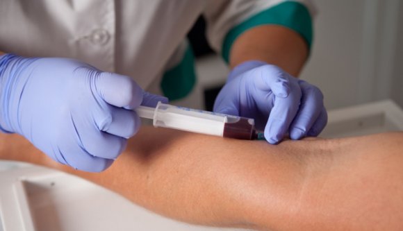 Véget érnek a végeérhetetlen sorok az orvosi laboratóriumok előtt?