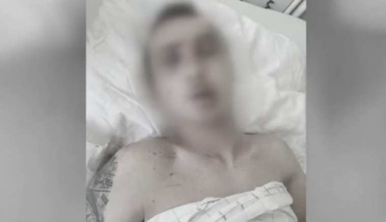 Megvertek, meztelenre vetkőztettek és eszméletlen állapotban magára hagytak egy fiatalt Aradon