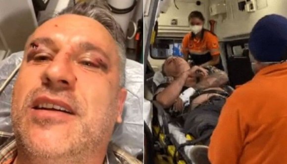 Belügyminiszter: törvényesen vágta a fát a társaság, amely brutálisan megvert két újságírót és egy környezetvédőt