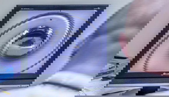 Egymillió eurós MRI-készüléket vág rendszeresen tönkre a gyakori áramkimaradás Aradon