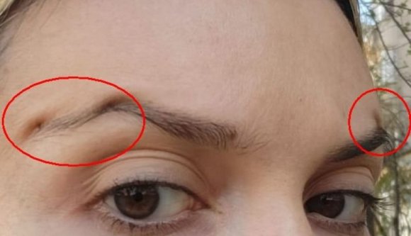 Engedélye sem volt, hentesmunkát is végzett egy Törökországból érkezett „orvos”