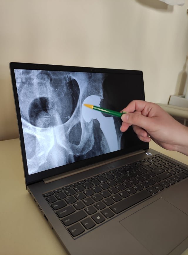 Műtét utáni röntgenfelvétel &bullet;  Fotó: Barabás Orsolya