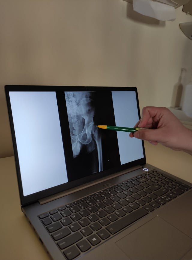 Műtét előtti röntgenfelvétel &bullet;  Fotó: Barabás Orsolya