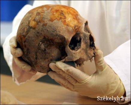 &bullet;  Fotó: illusztráció