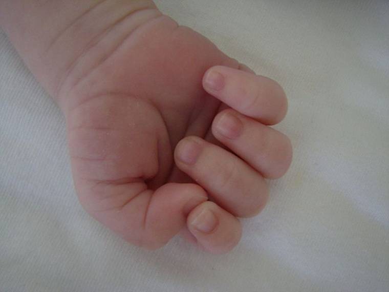 Megölte újszülött gyermekét egy árkosi nő