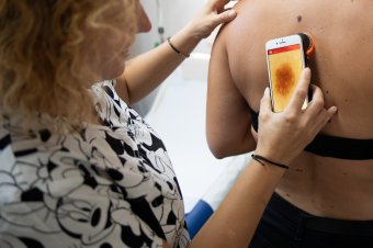 Félünk a bőrráktól, mégsem vesszük elég komolyan a megelőzést