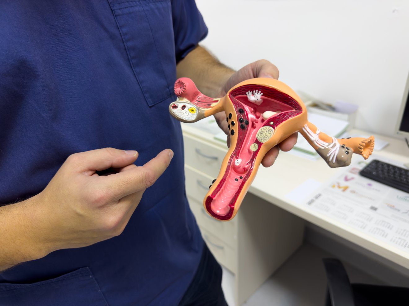 Az endometrium a petefészkekben, de akár a méhfalon is megtapadhat •  Fotó: Farkas Orsolya